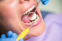 parodonte-parodontite-et-risque-de-perdre-des-dents-dentiste-marseille-st-tronc